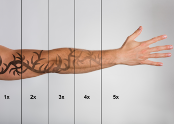 Tattoo Removal Costs Explained: From Single Sessions to Full Fades