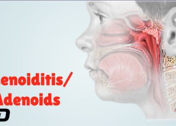 Adenoiditis: Symptoms, Causes, and Treatment Options